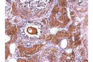 IHC-P Image NLK antibody [N3C3] detects NLK protein at cytosol and nucleus on mouse ovary by immunohistochemical analysis. (Nemo-Like Kinase 抗体)