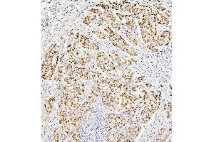 IHC analysis of H1F0 using anti-H1F0 antibody (ABIN7600521).