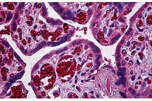 Human Placenta, Trophoblast: Formalin-Fixed, Paraffin-Embedded (FFPE) (ERBB3 抗体  (AA 21-332))