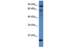 Western Blotting (WB) image for anti-Interleukin 4 Receptor (IL4R) (C-Term) antibody (ABIN2490400) (IL4 Receptor 抗体  (C-Term))