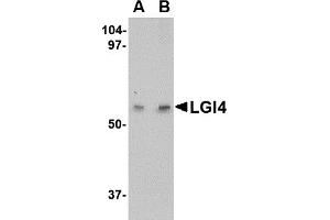 Western Blotting (WB) image for anti-Leucine-Rich Repeat LGI Family, Member 4 (LGI4) (Middle Region) antibody (ABIN1030984) (LGI4 抗体  (Middle Region))