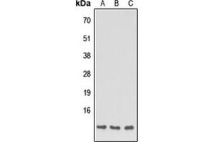 Western blot analysis of Apolipoprotein C1 expression in HEK293T (A), NS-1 (B), H9C2 (C) whole cell lysates. (APOC1 抗体  (Center))