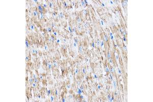 Immunohistochemistry of paraffin-embedded Mouse heart using L Rabbit pAb (ABIN7268192) at dilution of 1:100 (40x lens). (LATS2 抗体  (AA 1-100))