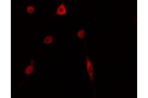 ABIN6274143 staining HepG2 cells by IF/ICC. (TOP3B 抗体  (C-Term))