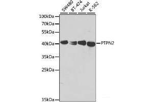 Western blot analysis of extracts of various cell lines using PTPN2 Polyclonal Antibody at dilution of 1:1000. (PTPN2 抗体)