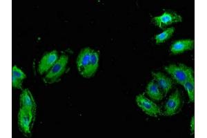 Immunofluorescence (IF) image for anti-Bone Morphogenetic Protein Receptor, Type IB (BMPR1B) (AA 14-126) antibody (ABIN7145708)