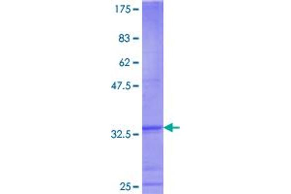 LASS5 Protein (AA 63-147) (GST tag)