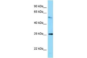 WB Suggested Anti-Memo1 Antibody   Titration: 1.