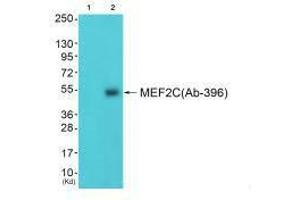 Western blot analysis of extracts from 3T3 cells (Lane 2), using MEF2C (Ab-396) antiobdy. (MEF2C 抗体  (Ser396))