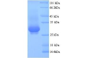 SDS-PAGE (SDS) image for VP4 (AA 247-479) protein (His tag) (ABIN5714038) (VP4 (AA 247-479) protein (His tag))