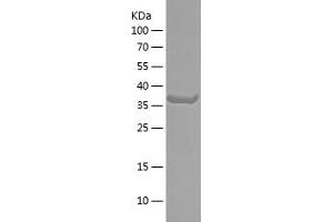 Western Blotting (WB) image for Netrin G1 (NTNG1) (AA 137-256) protein (His-IF2DI Tag) (ABIN7124135) (Netrin G1 Protein (NTNG1) (AA 137-256) (His-IF2DI Tag))