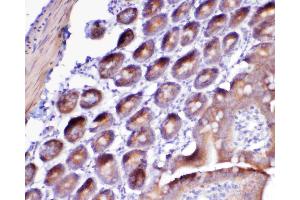 IHC analysis of Flt3 / CD135 using anti-Flt3 / CD135 antibody . (FLT3 抗体  (AA 62-295))