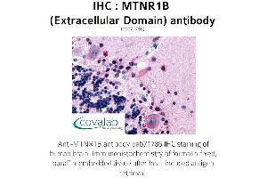 Image no. 1 for anti-Melatonin Receptor 1B (MTNR1B) (3rd Extracellular Domain) antibody (ABIN1737118) (Melatonin Receptor 1B 抗体  (3rd Extracellular Domain))