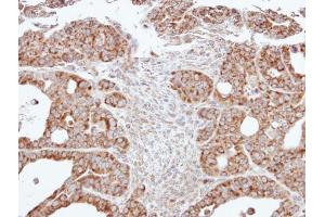 IHC-P Image Immunohistochemical analysis of paraffin-embedded NCI-N87 xenograft, using ACADM, antibody at 1:500 dilution. (Medium-Chain Specific Acyl-CoA Dehydrogenase, Mitochondrial (Center) 抗体)