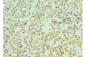 Immunohistochemistry of paraffin-embedded human spleen tissue using ABIN7156941 at dilution of 1:100 (IL-9 抗体  (AA 19-144))