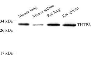 Western blot analysis of THTPA (ABIN7075879),at dilution of 1: 800 (THTPA 抗体)