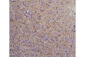 IHC analysis of Hexokinase 1/HK1 using anti-Hexokinase 1/HK1 antibody (ABIN7600260).