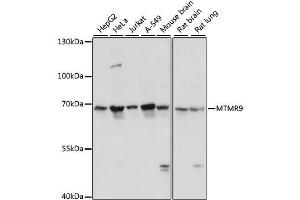 Western blot analysis of extracts of various cell lines, using MTMR9 antibody. (MTMR9 抗体  (AA 1-250))