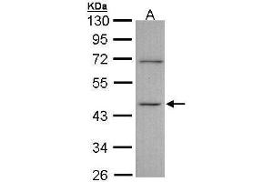 WB Image Sample (30 ug of whole cell lysate) A: A431 , 10% SDS PAGE antibody diluted at 1:1000 (ITPK1 抗体)