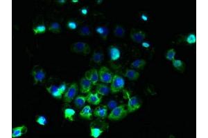 Immunofluorescent analysis of A431 cells using ABIN7144889 at dilution of 1:100 and Alexa Fluor 488-congugated AffiniPure Goat Anti-Rabbit IgG(H+L) (ABCB5 抗体  (AA 547-760))