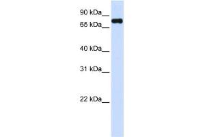 WB Suggested Anti-ZFYVE1 Antibody Titration:  0. (ZFYVE1 抗体  (C-Term))