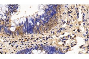 Immunohistochemistry (IHC) image for anti-Mitogen-Activated Protein Kinase 1 (MAPK1) (AA 25-360) antibody (ABIN7445753)