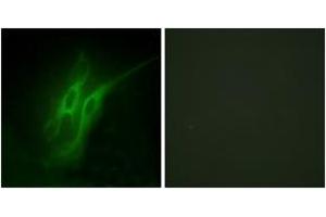 Immunofluorescence analysis of HeLa cells, using 5-HT-4 Antibody. (Serotonin Receptor 4 抗体  (AA 21-70))