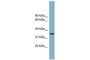 ApoH antibody used at 1 ug/ml to detect target protein. (APOH 抗体)