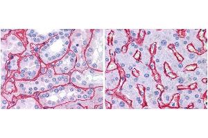 Anti collagen IV antibody (1:400, 45 min RT) showed strong staining in FFPE sections of human kidney (Left) with strong red staining observed in glomeruli and liver (Right) with strong staining in sinusoids. (Collagen IV 抗体)