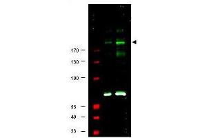 Image no. 1 for anti-Insulin Receptor Substrate 1 (IRS1) (pSer307) antibody (ABIN199910) (IRS1 抗体  (pSer307))