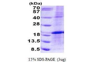 SDS-PAGE (SDS) image for LIM Domain Only 1 (Rhombotin 1) (LMO1) (AA 1-156) protein (His tag) (ABIN6387185)