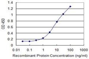 Detection limit for recombinant GST tagged SMO is 0. (SMO 抗体  (AA 653-787))