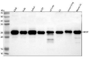 Western blot analysis of HBEGF using anti-HBEGF antibody (ABIN7605059).