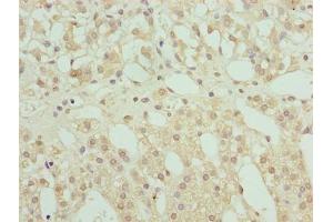 Immunohistochemistry of paraffin-embedded human adrenal gland tissue using ABIN7168234 at dilution of 1:100 (RING1 抗体  (AA 401-630))