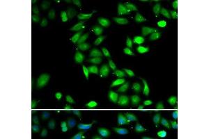 Immunofluorescence analysis of HeLa cells using PDCD6 Polyclonal Antibody (PDCD6 抗体)