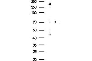 anti-NUAK Family, SNF1-Like Kinase, 2 (NUAK2) (Internal Region) antibody