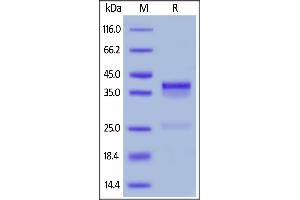 SDS-PAGE (SDS) image for Connective Tissue Growth Factor (CTGF) (AA 26-348) protein (His tag) (ABIN6388278)
