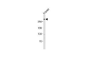 Anti-LRRK2 Antibody (C-term) at 1:1000 dilution + human brain lysates Lysates/proteins at 20 μg per lane.