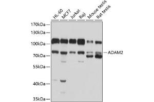 Western blot analysis of extracts of various cell lines, using  antibody (ABIN6131159, ABIN6136527, ABIN6136528 and ABIN6214340) at 1:1000 dilution.