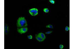 Immunofluorescence staining of MCF-7 cells with ABIN7168803 at 1:166, counter-stained with DAPI. (SEMA4D/CD100 抗体  (AA 756-862))