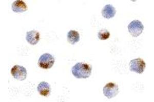Immunohistochemistry (IHC) image for anti-Apoptotic Chromatin Condensation Inducer 1 (ACIN1) (Middle Region) antibody (ABIN1030843) (ACIN1 抗体  (Middle Region))