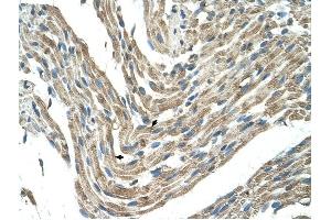 FBXL5 antibody was used for immunohistochemistry at a concentration of 4-8 ug/ml to stain Skeletal muscle cells (arrows) in Human Muscle. (FBXL5 抗体  (Middle Region))