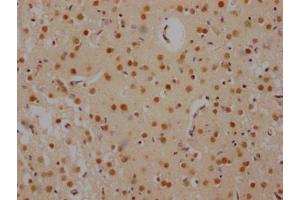 Immunohistochemistry (IHC) image for anti-Far Upstream Element (FUSE) Binding Protein 1 (FUBP1) antibody (ABIN7127503)