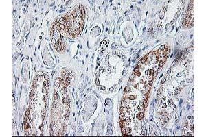 Immunohistochemical staining of paraffin-embedded Human Kidney tissue using anti-SIRT5 mouse monoclonal antibody. (SIRT5 抗体)