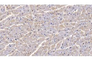 Detection of CNX in Human Cardiac Muscle Tissue using Monoclonal Antibody to Calnexin (CNX) (Calnexin 抗体  (AA 239-461))