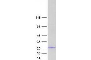 Validation with Western Blot