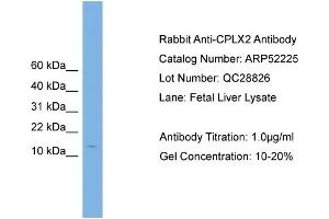 WB Suggested Anti-CPLX2  Antibody Titration: 0. (CPLX2 抗体  (N-Term))