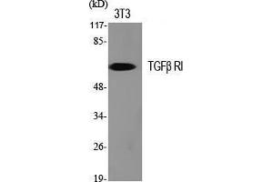 Western Blot (WB) analysis of specific cells using TGFbeta RI Polyclonal Antibody. (TGFBR1 抗体  (Tyr159))