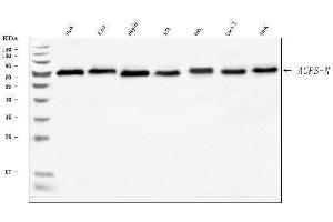 Western blot analysis of AGPS using anti-AGPS antibody (ABIN7600146).