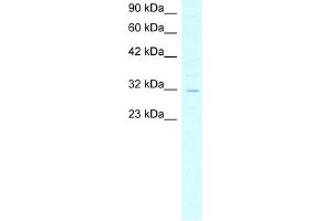 WB Suggested Anti-ASGR2 Antibody Titration:  4. (Asialoglycoprotein Receptor 2 抗体  (N-Term))